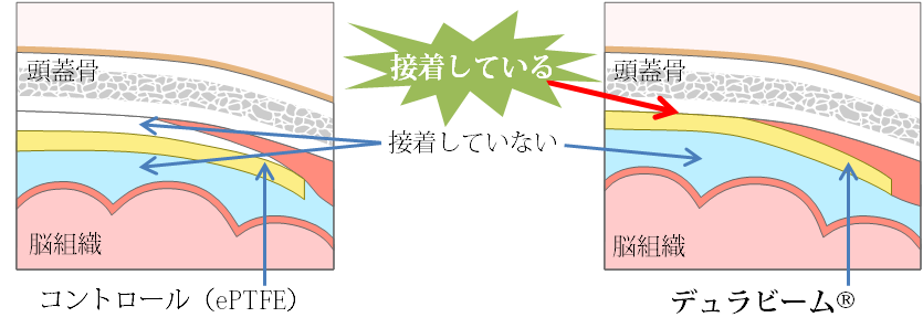 エムスリーグループで理研シーズを製品化 人工硬膜 デュラビーム 国内製造販売承認のお知らせ エムスリー株式会社